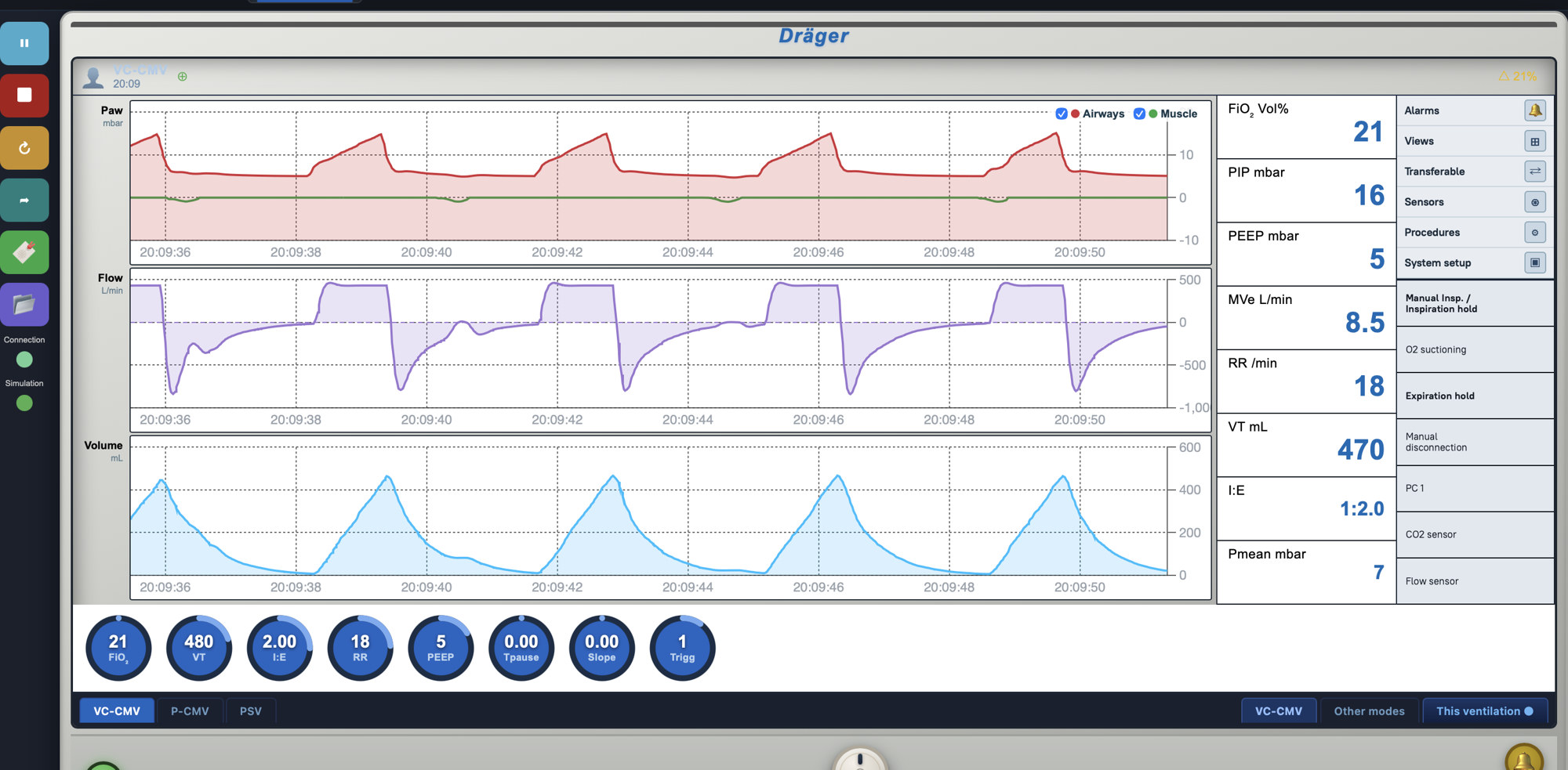 Dräger ventilator monitor screen with real-time Paw, Flow, and Volume waveforms