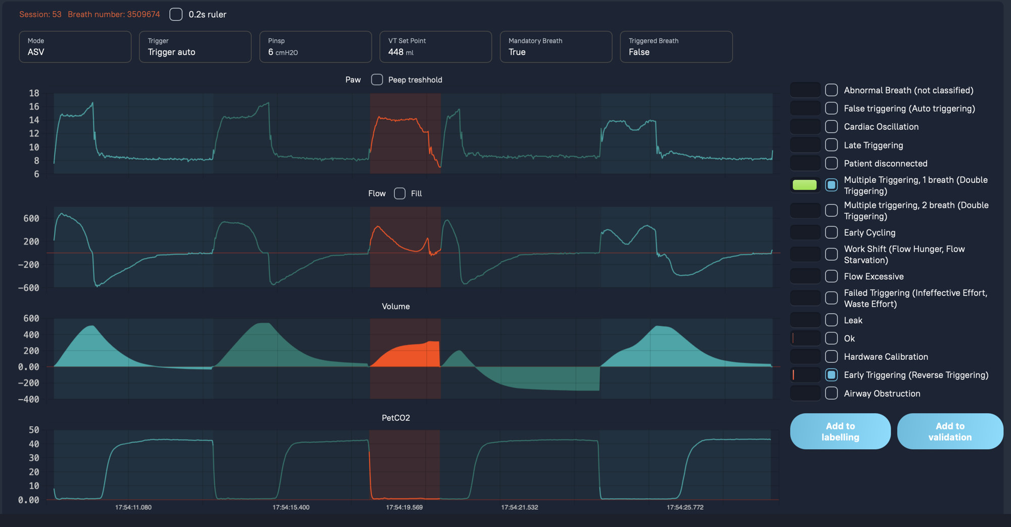 Breath waveform analysis with Paw, Flow, Volume, PetCO2